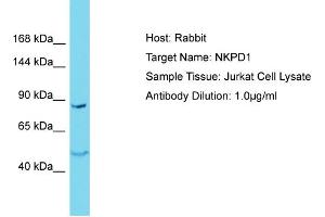 Host: Rabbit Target Name: NKPD1 Sample Type: Jurkat Whole Cell lysates Antibody Dilution: 1. (NKPD1 Antikörper  (N-Term))
