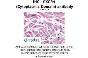 Image no. 1 for anti-Chemokine (C-X-C Motif) Receptor 4 (CXCR4) antibody (ABIN1733405) (CXCR4 Antikörper)