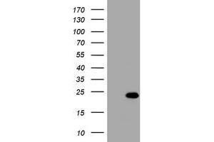 Image no. 1 for anti-Visinin-Like 1 (VSNL1) (AA 2-191) antibody (ABIN1491144) (VSNL1 Antikörper  (AA 2-191))