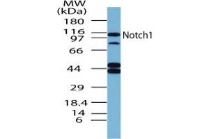Image no. 1 for anti-Notch 1 (NOTCH1) (AA 1755-1767) antibody (ABIN207749) (Notch1 Antikörper  (AA 1755-1767))