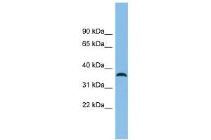 C18orf25 antibody used at 1 ug/ml to detect target protein. (C18ORF25 Antikörper  (N-Term))