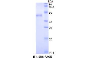 SDS-PAGE (SDS) image for Toll-Like Receptor 4 (TLR4) ELISA Kit (ABIN6574197)