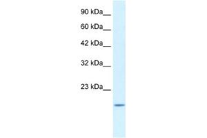 WB Suggested Anti-BAX Antibody Titration:  1. (BAX Antikörper  (N-Term))