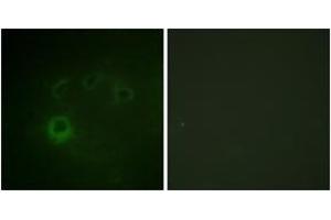Immunofluorescence analysis of COS7 cells, using p70 S6 Kinase (Phospho-Ser418) Antibody. (RPS6KB1 Antikörper  (pSer418))