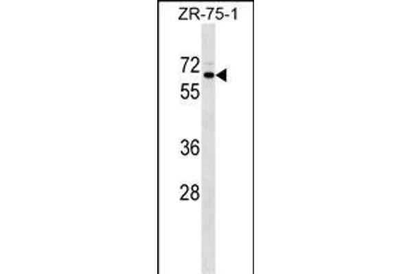 SRPR Antikörper  (C-Term)