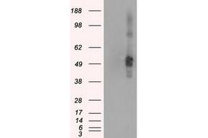 HEK293T cells were transfected with the pCMV6-ENTRY control (Left lane) or pCMV6-ENTRY CD4 (Right lane) cDNA for 48 hrs and lysed. (CD4 Antikörper)