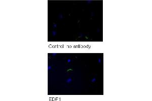 WB Suggested Anti-GPD1 Antibody    Titration: 5 ug/ml   Positive Control: HG (EDF1 Antikörper  (N-Term))