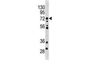 MELK antibody used in western blot to detect MRLK/MELK in mouse brain tissue lysate. (MELK Antikörper  (AA 201-230))