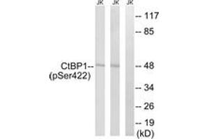 Western blot analysis of extracts from Jurkat cells treated with TNF 20ng/ml 30' and Jurkat cells treated with UV 15', using CtBP1 (Phospho-Ser422) Antibody. (CTBP1 Antikörper  (pSer422))