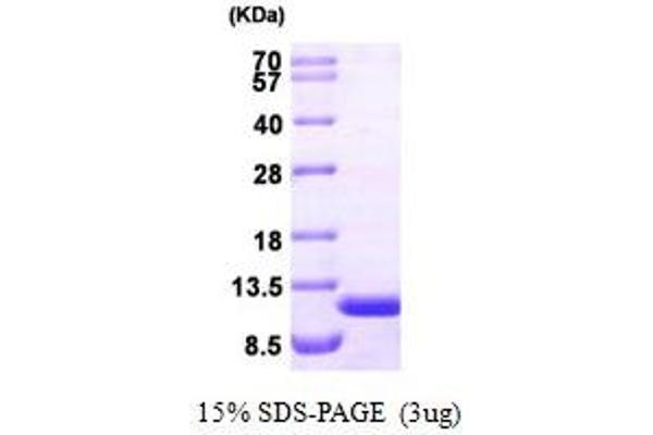 aHSP Protein (AA 1-102)