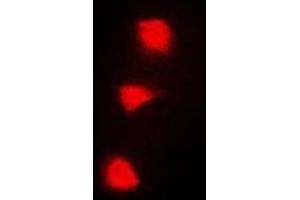 Immunofluorescent analysis of SPZ1 staining in A549 cells. (SPZ1 Antikörper  (N-Term))