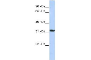WB Suggested Anti-SMNDC1 Antibody Titration:  0. (SMNDC1 Antikörper  (C-Term))