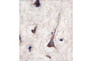 Immunohistochemistry (IHC) image for anti-CD3g Molecule, gamma (CD3-TCR Complex) (CD3G) antibody (ABIN2998378) (CD3G Antikörper)