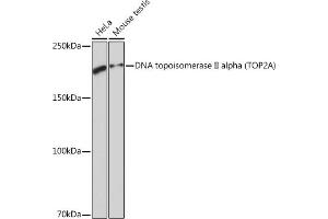 Western blot analysis of extracts of various cell lines, using DNA DNA topoisomerase II alpha (TOP2A) (TOP2A) Rabbit mAb (ABIN7270852) at 1:1000 dilution. (Topoisomerase II alpha Antikörper)