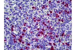 Anti-CAMP antibody IHC of human spleen, neutrophils. (Cathelicidin Antikörper)