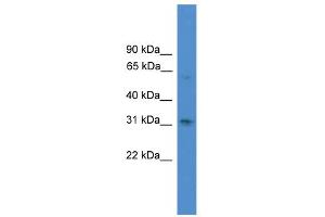 WB Suggested Anti-RUNX2 Antibody Titration:  0. (RUNX2 Antikörper  (N-Term))