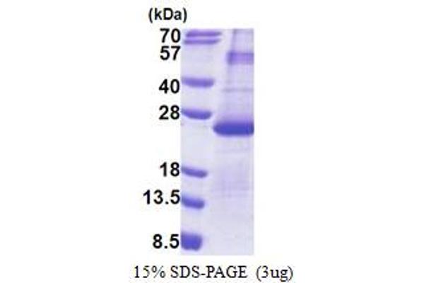 DUSP26 Protein (AA 1-211) (His tag)