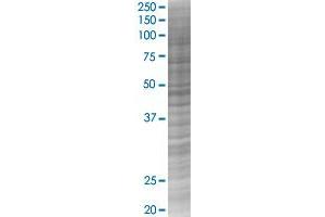 GABPB2 transfected lysate. (GABPB2 293T Cell Transient Overexpression Lysate(Denatured))