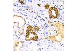 Immunohistochemistry of paraffin-embedded human kidney using KRT15 antibody. (KRT15 Antikörper)