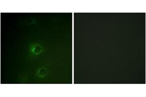 Immunofluorescence analysis of COS7 cells, using CBL (Ab-700) Antibody. (CBL Antikörper  (AA 666-715))