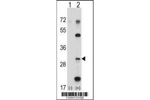 Western blot analysis of PSMB5 using rabbit polyclonal PSMB5 Antibody using 293 cell lysates (2 ug/lane) either nontransfected (Lane 1) or transiently transfected (Lane 2) with the PSMB5 gene. (PSMB5 Antikörper  (C-Term))