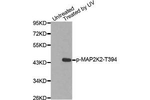 Western Blotting (WB) image for anti-Mitogen-Activated Protein Kinase Kinase 2 (MAP2K2) (pThr394) antibody (ABIN1870344) (MEK2 Antikörper  (pThr394))