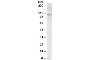 Western blot testing of MOLT4 lysate with NFATC2 antibody at 0. (NFAT1 Antikörper)