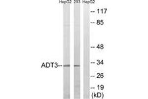 Western blot analysis of extracts from HepG2/293 cells, using SLC25A6 Antibody. (SLC25A6 Antikörper  (AA 121-170))