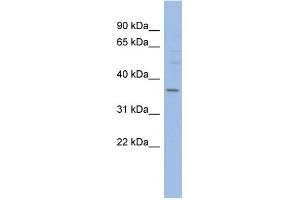 WB Suggested Anti-HMGCLL1 Antibody Titration: 0. (HMGCLL1 Antikörper  (N-Term))