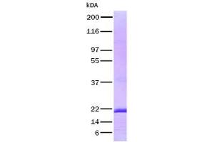 Validation with Western Blot (FGF7 Protein)