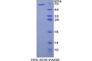 SDS-PAGE (SDS) image for Prothrombin Fragment 1+2 (F1+2) ELISA Kit (ABIN6574193)