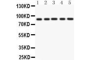 Anti- CD36 Picoband antibody, Western blotting All lanes: Anti CD36  at 0. (CD36 Antikörper  (N-Term))