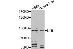 Western blot analysis of extracts of K562 and mouse liver cells, using LY9 antibody. (LY9 Antikörper)