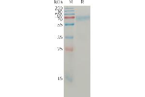 Human AN(19-496) Protein, His Tag on SDS-PAGE under reducing condition. (Angiopoietin 2 Protein (ANGPT2) (AA 19-496) (His tag))