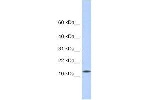 CDRT4 antibody used at 1 ug/ml to detect target protein. (CDRT4 Antikörper  (Middle Region))