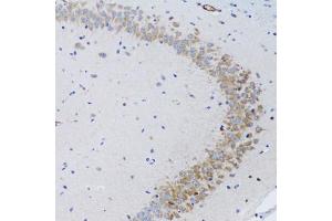 Immunohistochemistry of paraffin-embedded rat brain using TNFSF12 Antibody (ABIN1876860) at dilution of 1:100 (20x lens). (TWEAK Antikörper)