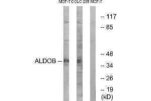 Western blot analysis of extracts from MCF-7 cells and HUVEC cells, using ALDOB antibody. (ALDOB Antikörper  (Internal Region))