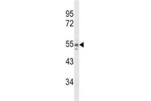 Western blot analysis of NAMPT antibody and A375 lysate (NAMPT Antikörper  (AA 400-426))