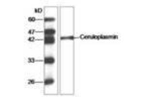 Image no. 1 for anti-Ceruloplasmin (Ferroxidase) (CP) (AA 933-1065) antibody (ABIN791453) (Ceruloplasmin Antikörper  (AA 933-1065))