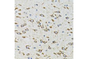 Immunohistochemistry of paraffin-embedded rat brain using AKTIP antibody (ABIN5973673) at dilution of 1/100 (40x lens). (AKTIP Antikörper)