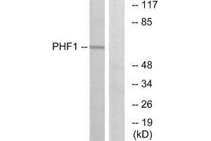 Western Blotting (WB) image for anti-PHD Finger Protein 1 (PHF1) (Internal Region) antibody (ABIN1848964) (PHF1 Antikörper  (Internal Region))