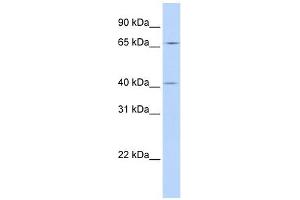 ASAP3 antibody used at 1 ug/ml to detect target protein. (ASAP3 Antikörper  (N-Term))