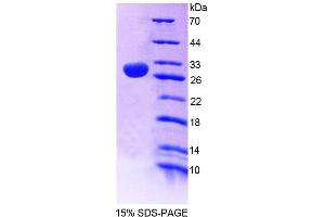 SDS-PAGE analysis of Human CNP Protein. (Cnpase Protein)