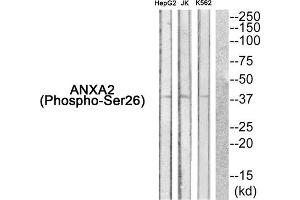 Western Blotting (WB) image for anti-Annexin A2 (ANXA2) (pSer26) antibody (ABIN1847876) (Annexin A2 Antikörper  (pSer26))