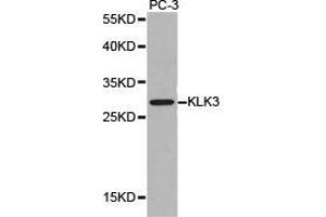 Western Blotting (WB) image for anti-Prostate Specific Antigen (PSA) antibody (ABIN1873444) (Prostate Specific Antigen Antikörper)