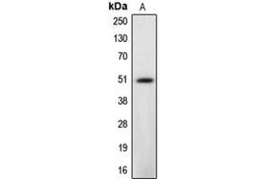 Western blot analysis of Caspase 12 expression in L929 (A) whole cell lysates. (Caspase 12 Antikörper  (Center))
