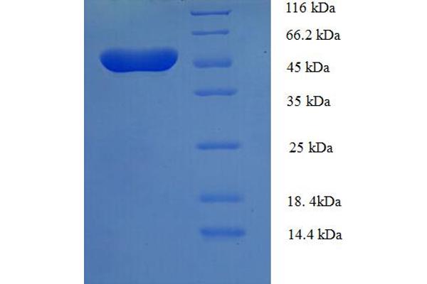 TEAD3 Protein (AA 112-435, partial) (His-SUMO Tag)