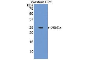 Western Blotting (WB) image for anti-Caldesmon 1 (CALD1) (AA 28-207) antibody (ABIN1858221) (Caldesmon Antikörper  (AA 28-207))