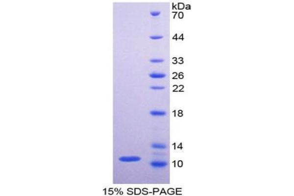 PKM Protein