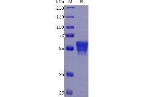 Human CD7 Protein, mFc Tag on SDS-PAGE under reducing condition. (CD7 Protein (CD7) (AA 26-180) (mFc Tag))
